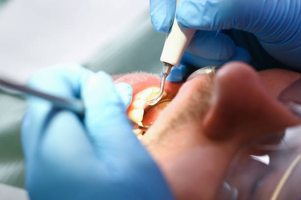 Best Pediatric Emergency Dentist in Atasdero, CA