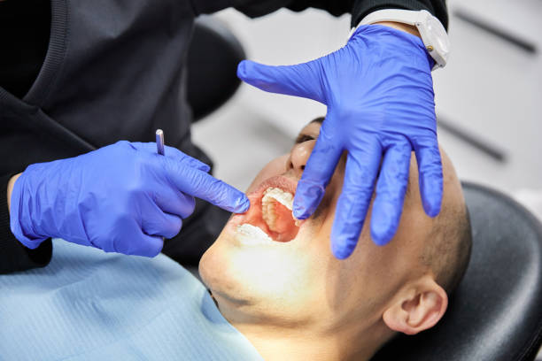 Best Emergency Dental Extractions in Atasdero, CA